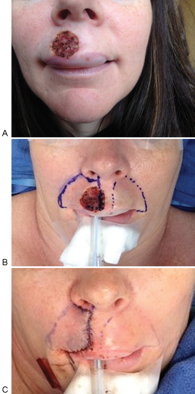 Fig. 11