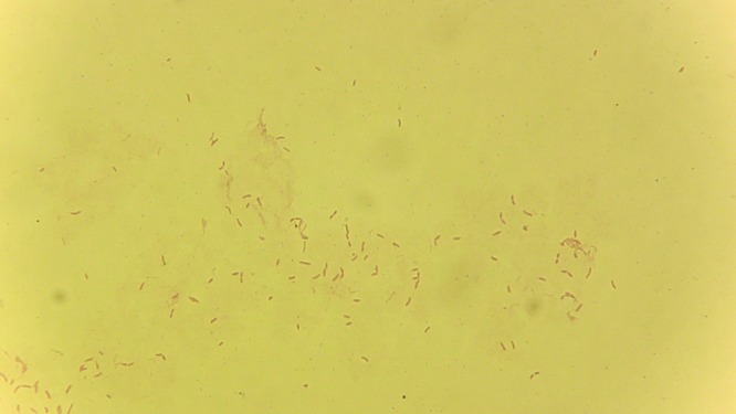 FIG 2