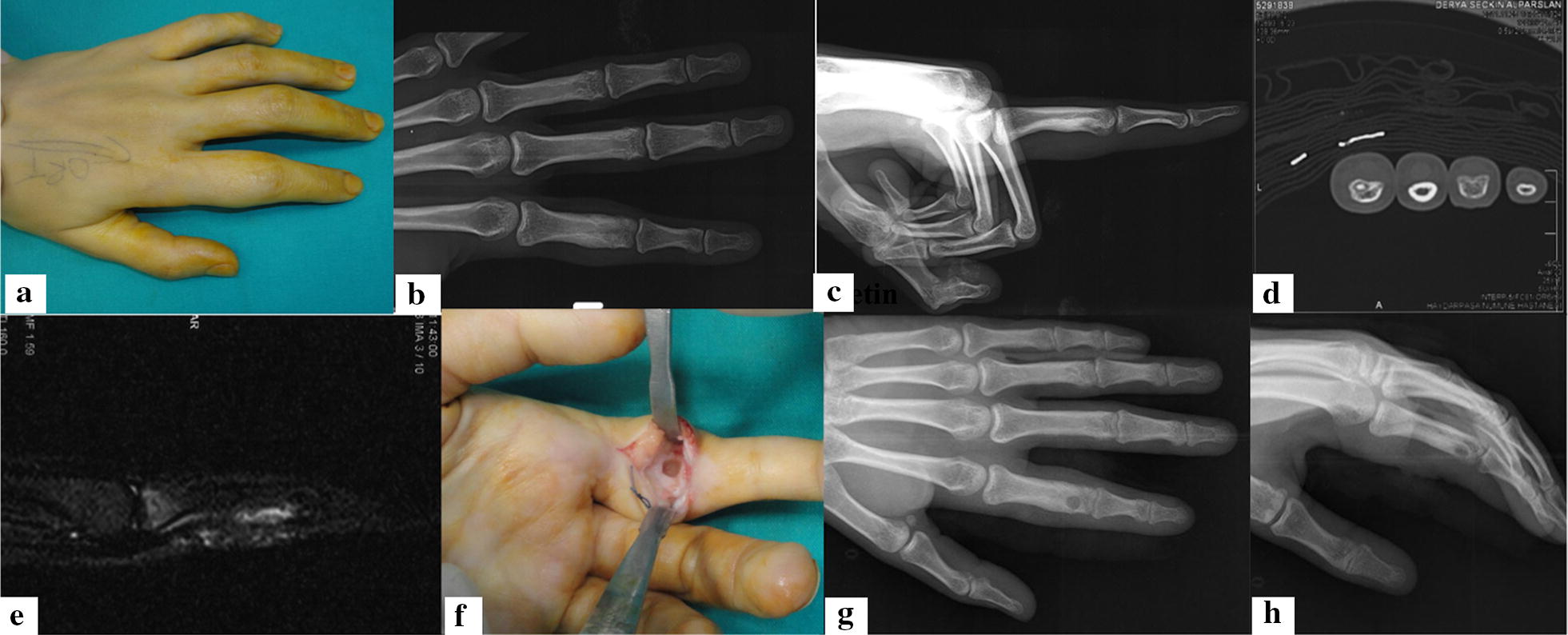 Fig. 1