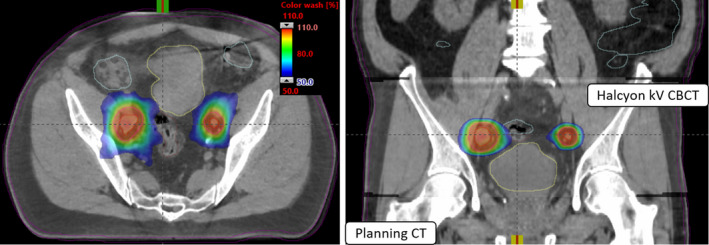 Fig. 4