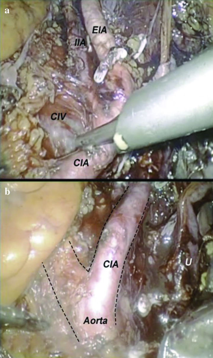 Figure 3 a, b