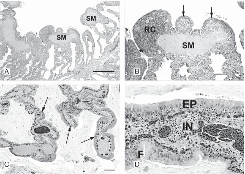 FIG 2 