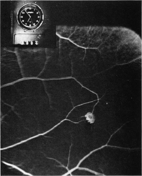 FIGURE 14B