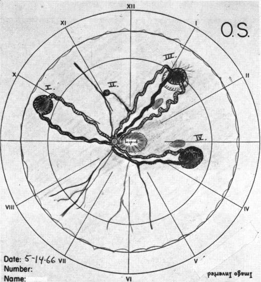 FIGURE 21