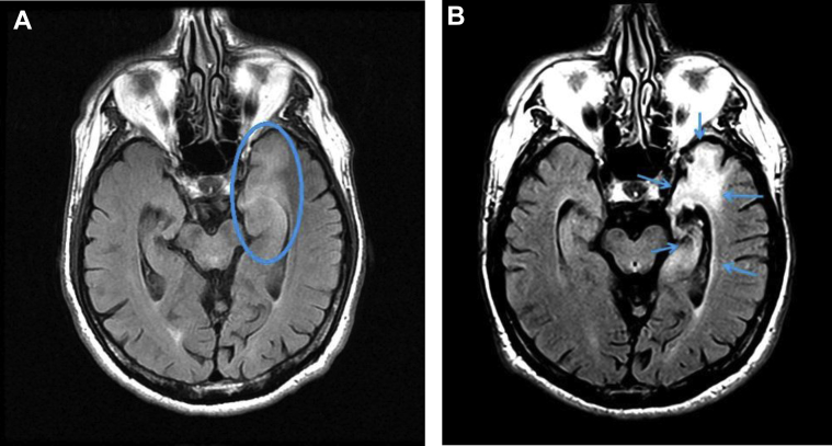 Fig. 1