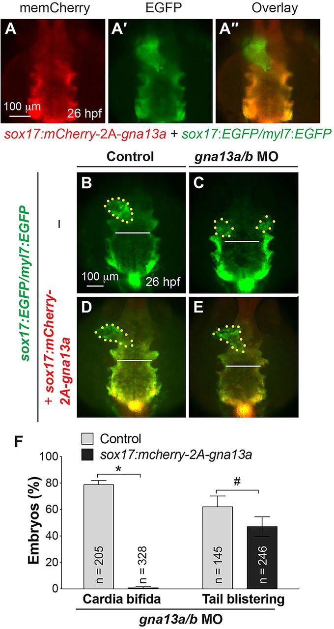 Fig. 1. Endoderm-specific expression of Gα13 rescues defects in migration of the endoderm and myocardial cells caused by global Gα13 depletion. (A-A″) Epifluorescence images of anterior endoderm and myocardial cells in embryos indicated. (B-E) Epifluorescence images of anterior endoderm of control and gna13a/b MO-injected embryos indicated. (F) Frequencies of cardia bifida and tail blistering in embryos indicated (same as in B-E) at 2 dpf. Dorso-anterior view, with anterior up; yellow dots, cardiomyocytes; white lines (equivalent length), width of the anterior endodermal sheet. *P<0.001, #P=0.25. Data are mean±s.e.m.