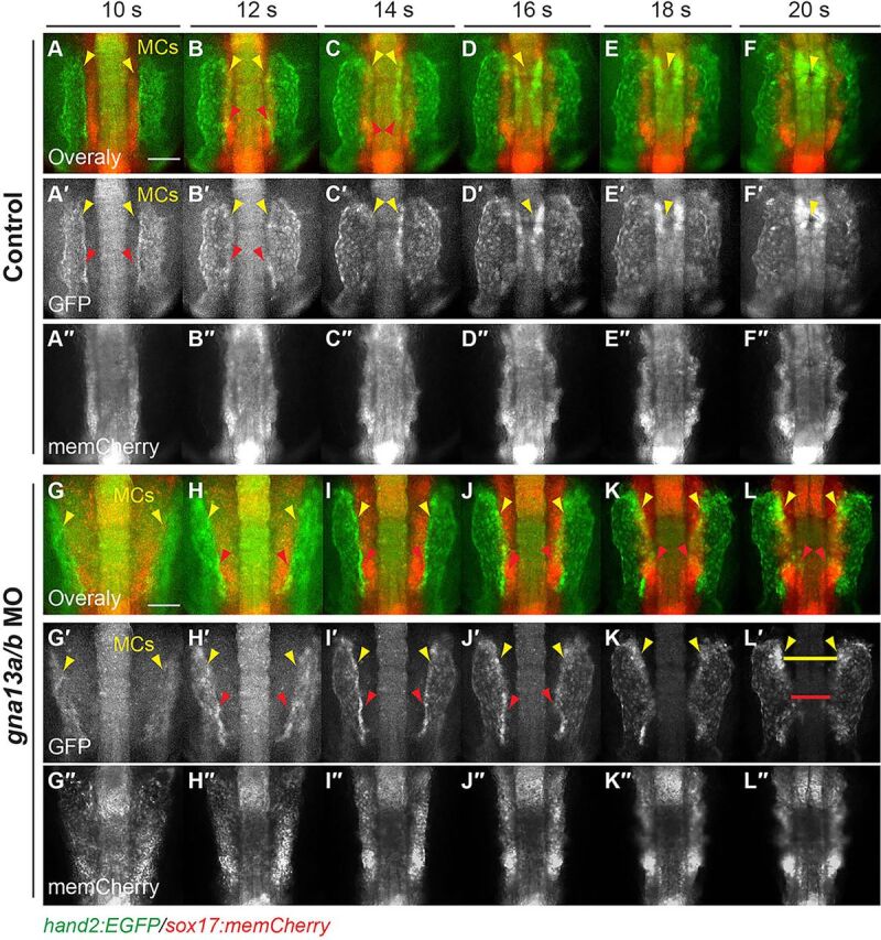 Fig. 9. The ALPM engages in endoderm-dependent subduction. Snapshots from epifluorescence time-lapse movies of control and gna13a/b MO-injected Tg(sox17:memCherry)/(hand2:EGFP) embryos at 10-20 s (supplementary material Movie 6). Dorso-anterior views. (A-L) Overlays of anterior memCherry-labeled endoderm (red) and Hand2:GFP-labeled ALPM (green). (A′-L′) Hand2:GFP-labeled ALPM. (A″-L″) memCherry-labeled endoderm. Yellow arrowheads indicate myocardial cells (MCs); red arrowheads indicate dorsalmost region of LPM cells; yellow and red lines indicate gap between the two myocardial populations and the dorsalmost region of LPM cells. Scale bars: 100 µm.