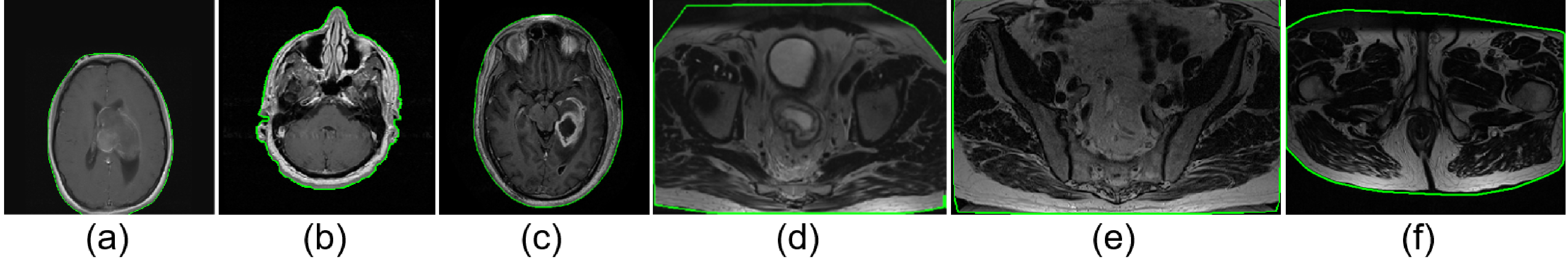 Figure 2: