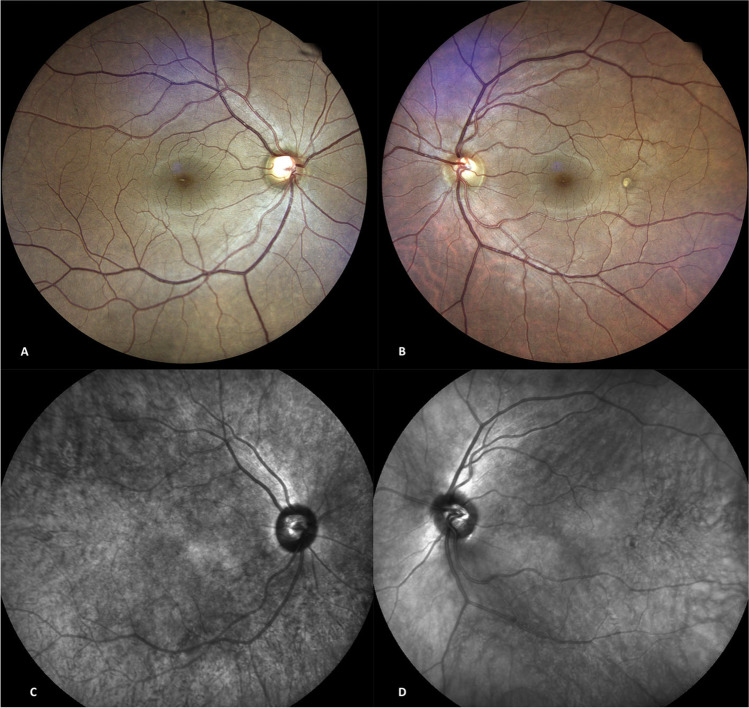 Fig. 4