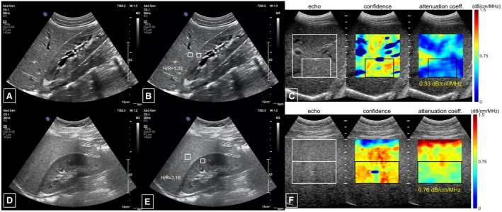 FIG 1