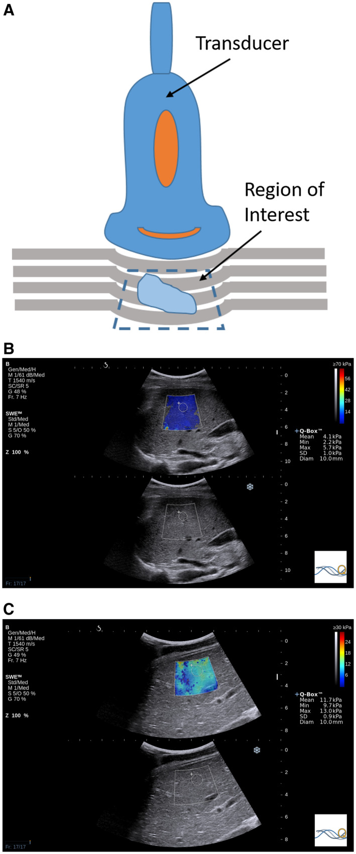 FIG 2