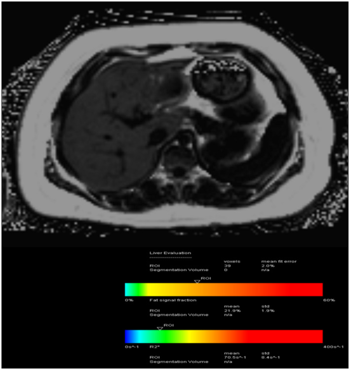 FIG 3