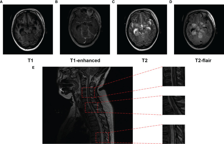 Figure 4