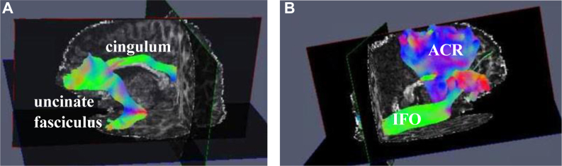 Figure 2