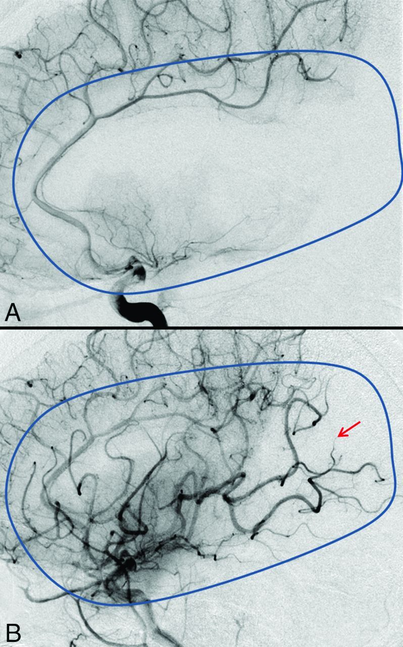 Fig 3.