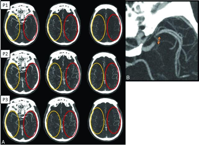 Fig 2.