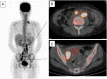 Fig. 2