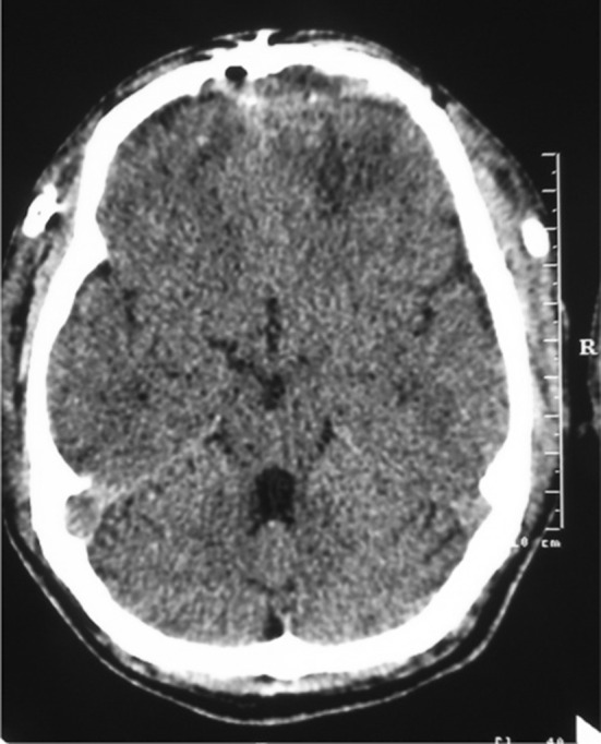 Fig. 5
