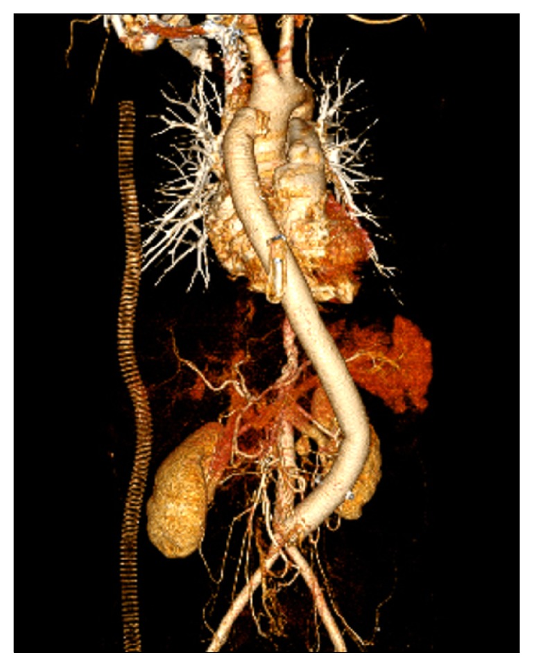 Fig. 3