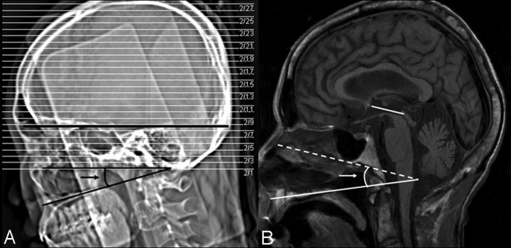 Fig 2.