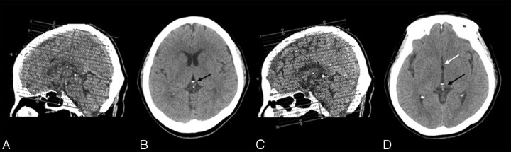 Fig 3.