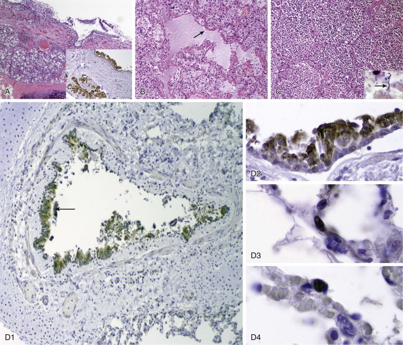 Figure 32-8