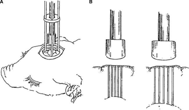 FIG. 1.