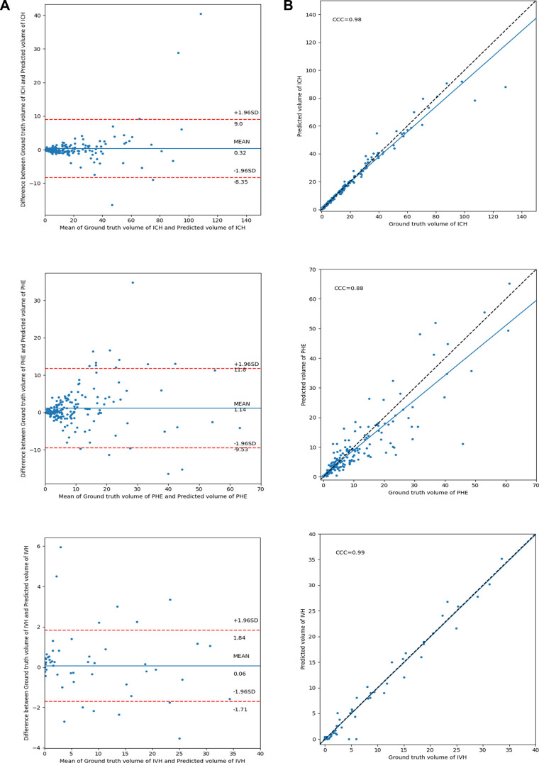 (A) Bland-Altman and (B) concordance plot of agreements between ground truth and predicted lesion volumes in the test cohort by using the Focal model. CCC = concordance correlation coefficient, ICH = intracerebral hemorrhage, IVH = intraventricular hemorrhage, PHE = perihematomal edema.