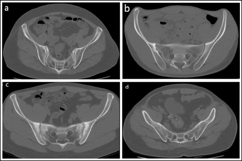 Fig.1