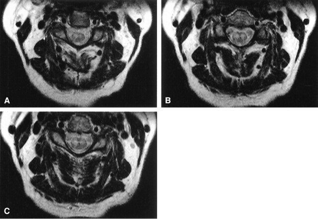 Fig 1.