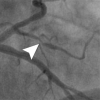 Figure 4c: