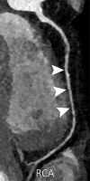 Figure 5b: