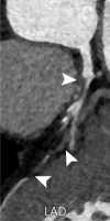 Figure 6b: