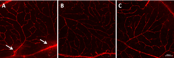 Figure 11