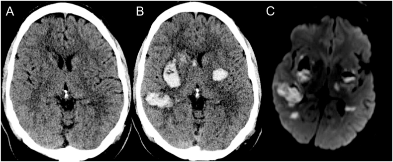 Fig. 1