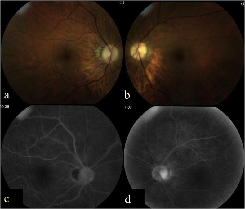 Fig. 2