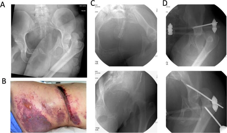 Fig. 1