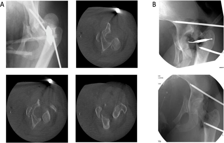 Fig. 2