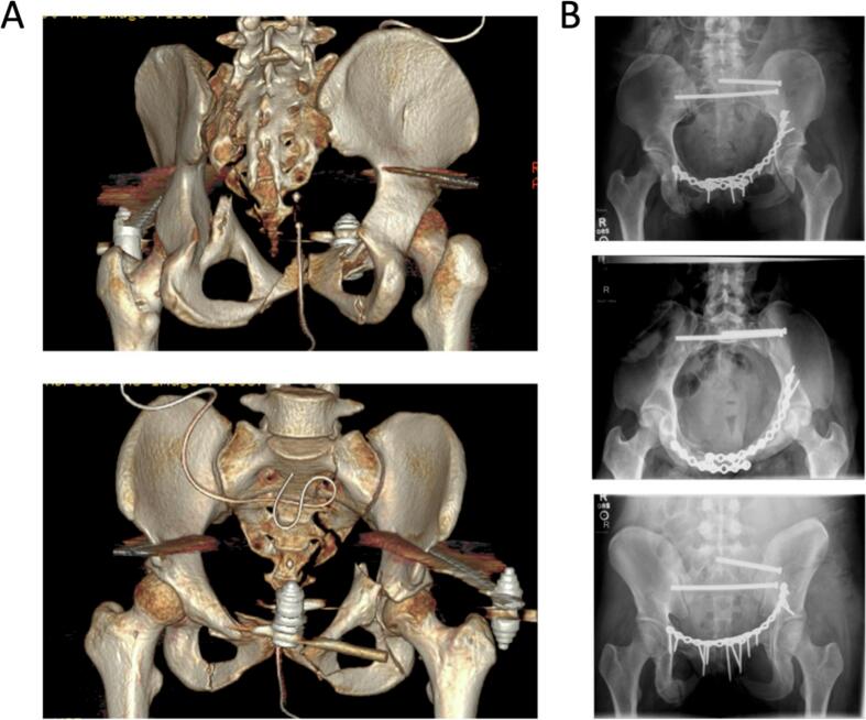 Fig. 3