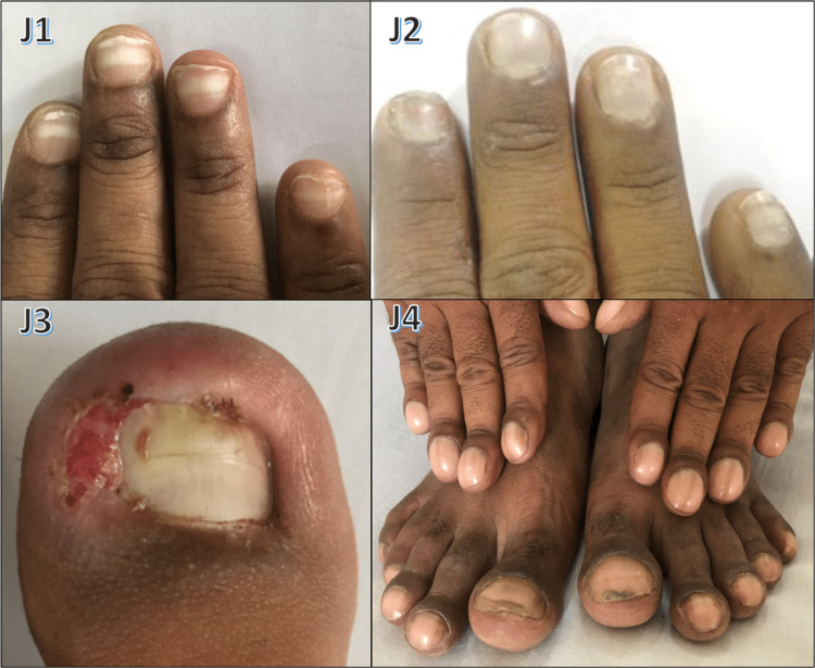 Figure 11