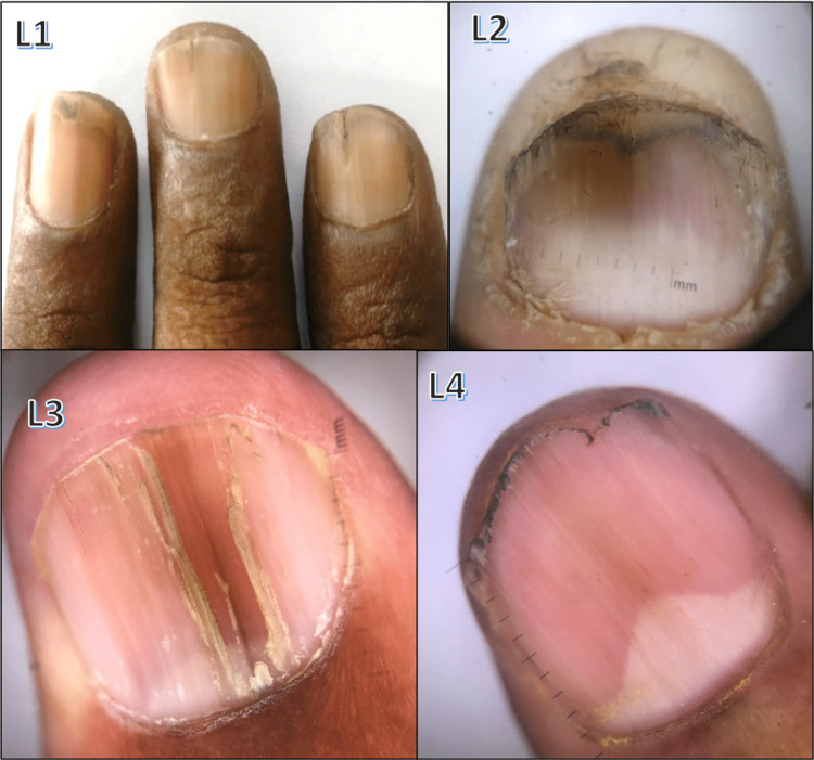 Figure 13