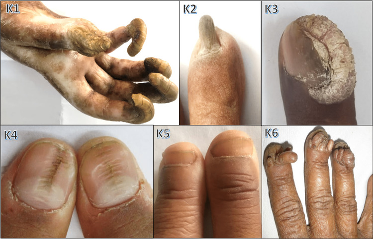 Figure 12