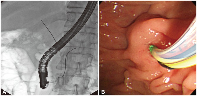 Fig. 1