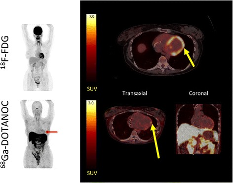 Fig. 4