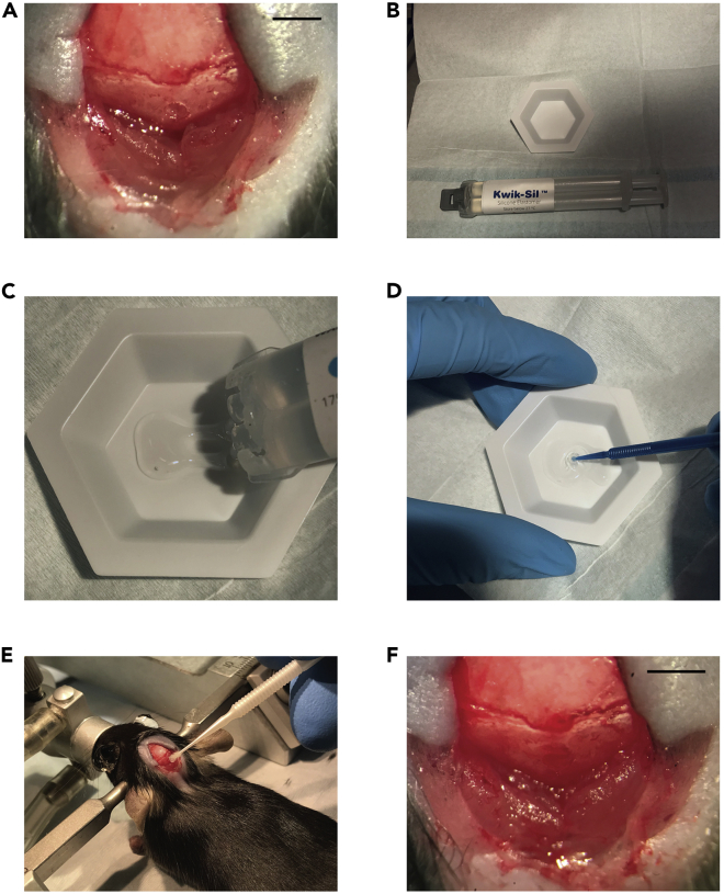 Figure 2