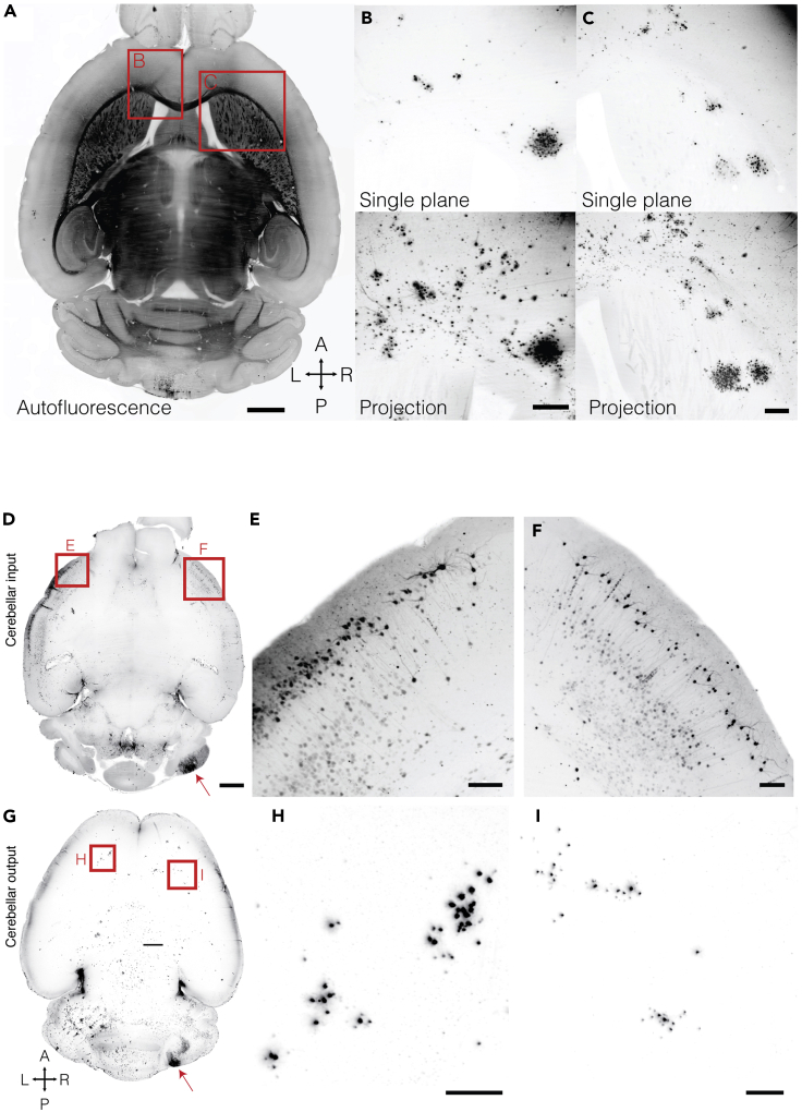 Figure 11