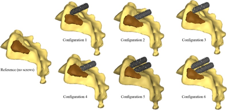 Fig. 10