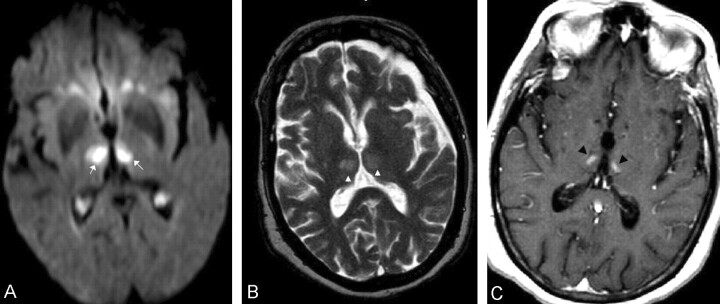 Fig 3.