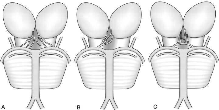 Fig 4.