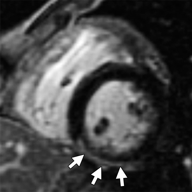 Figure 4b: